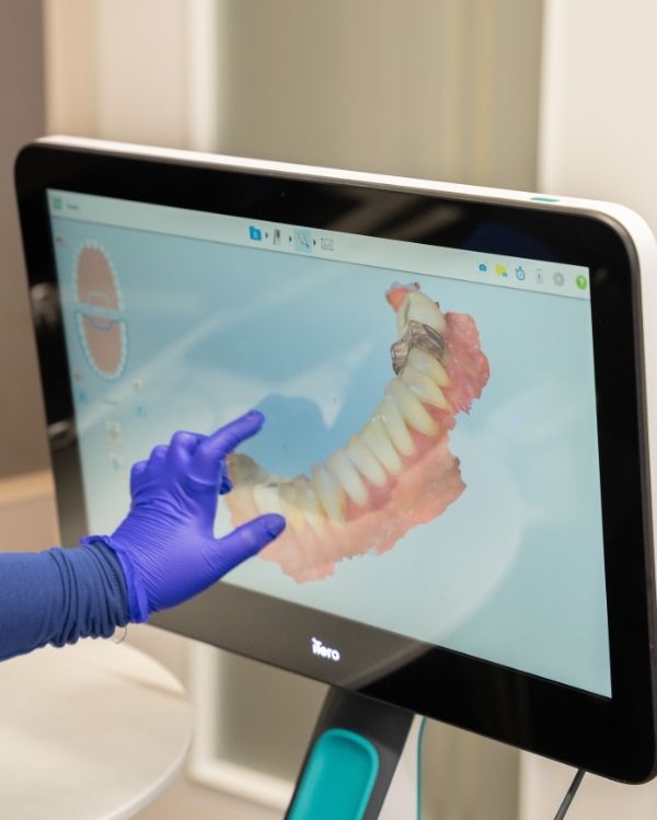 Digital Scanning