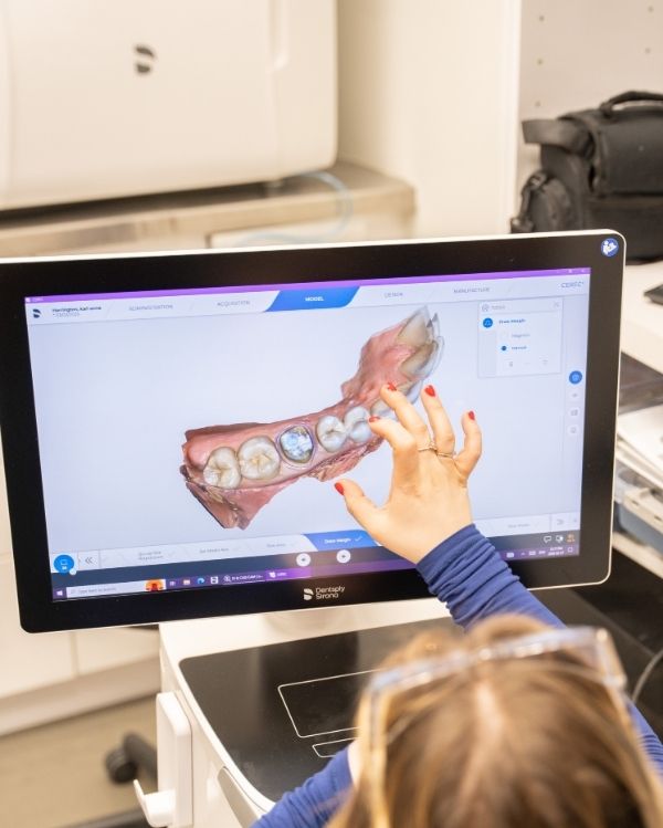 Digital Smile Design
