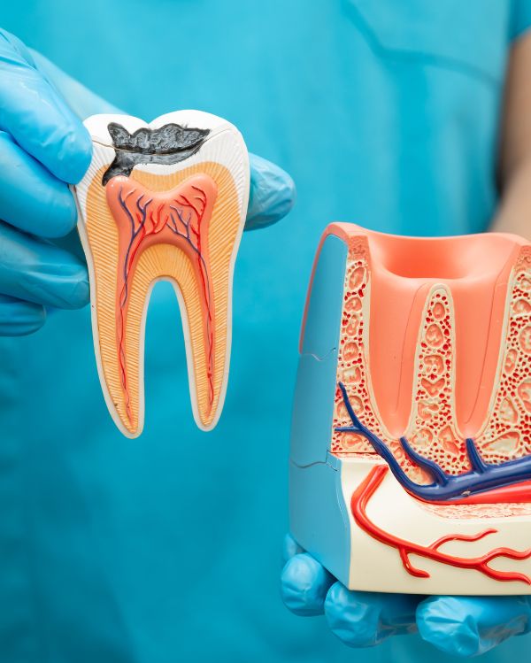 Root Canal Treatment