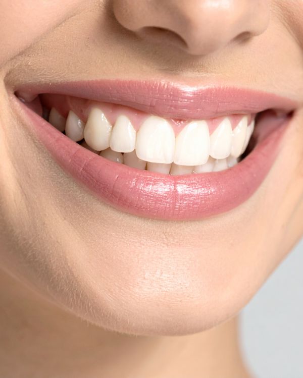 Teeth Whitening