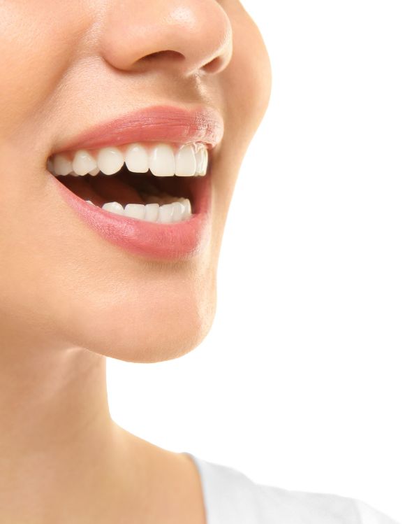 Smile Makeovers